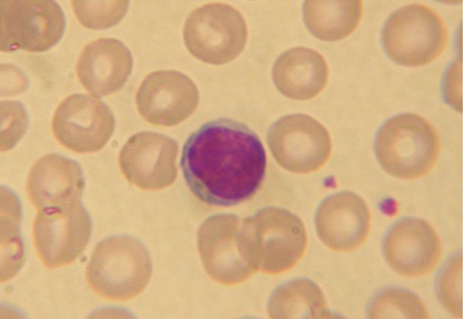 Frottis sanguin 

Source : Lymphocyte2.jpg par NicolasGrandjeanvia wikimédia commons, CC-BY-SA-3.0-migrated